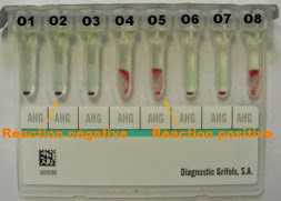 Photo d'une recherche d'anticorps réalisée en filtration