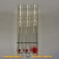 photo des réactions d'un test de coombs direct en tube