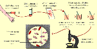 Schéma de la technique d'analyse du Kleihauer